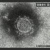 新型ウイルス 国内の感染確認520人に（クルーズ船454人含む） | NHKニュース